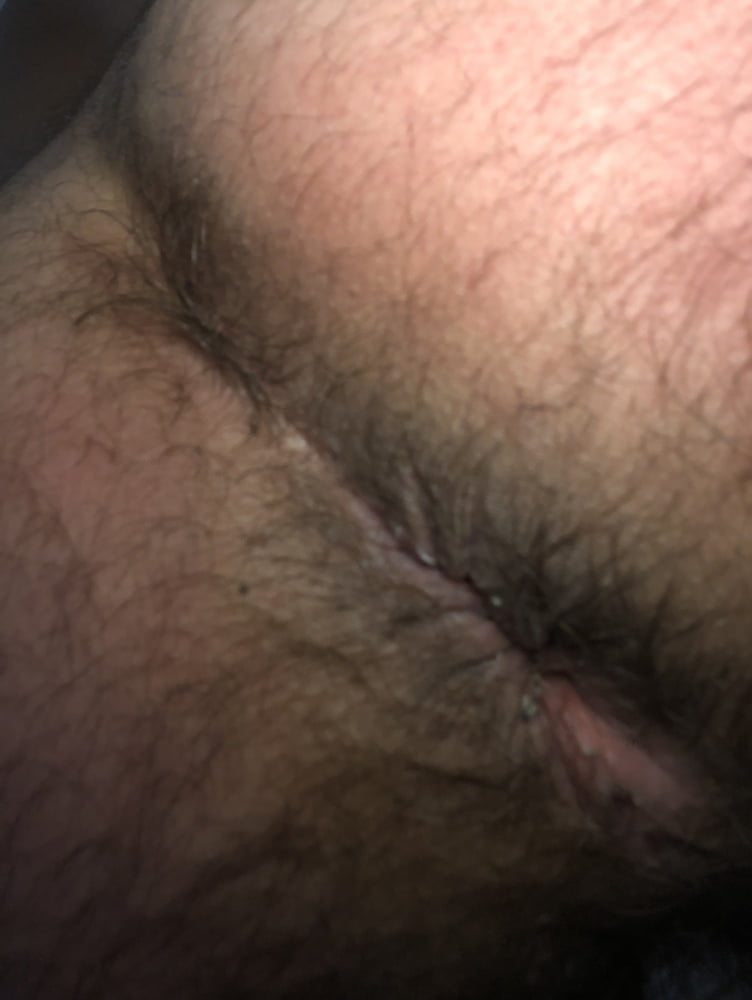 Dirty and hairy ass #96989496