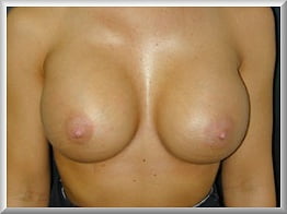 おっぱい
 #101955245