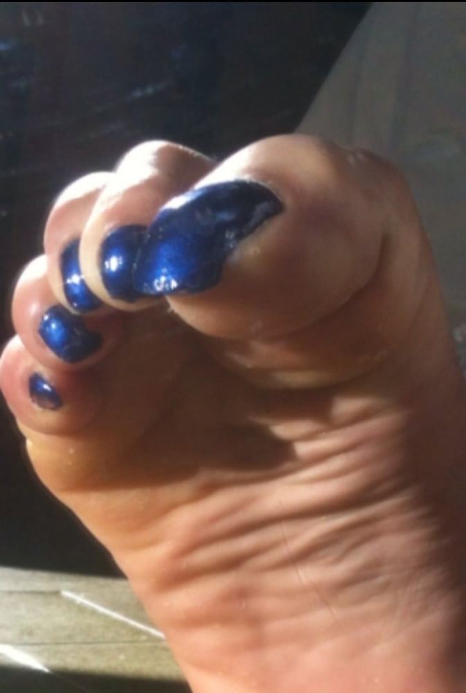 Blue toenails under sun ray #106845602