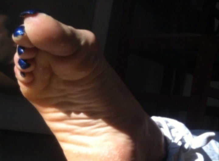 Blue toenails under sun ray #106845610