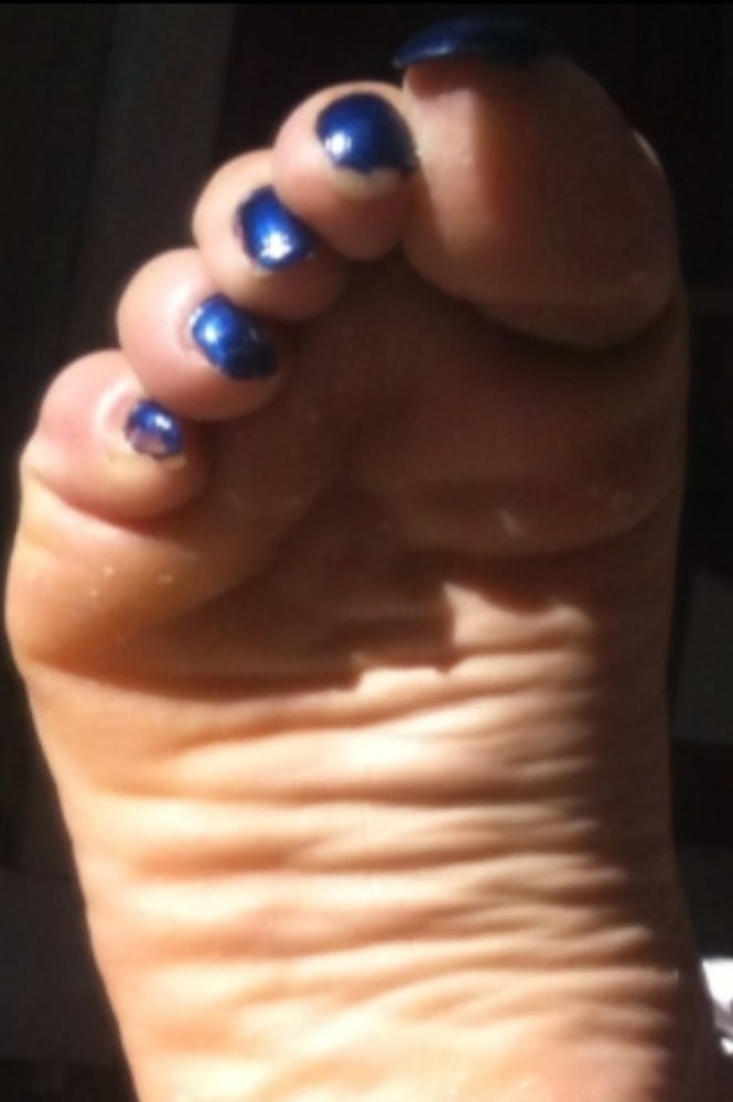 Blue toenails under sun ray #106845616