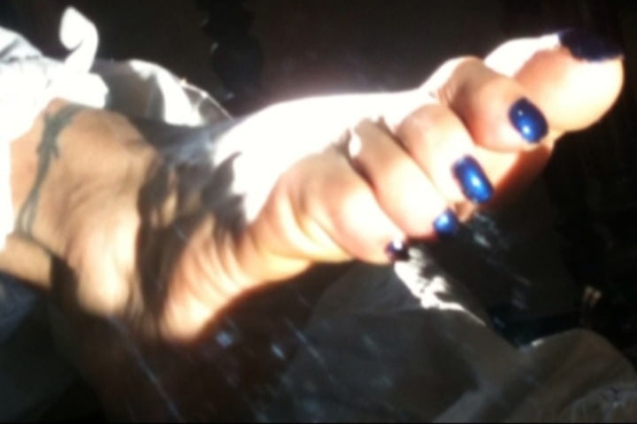 Blue toenails under sun ray #106845642