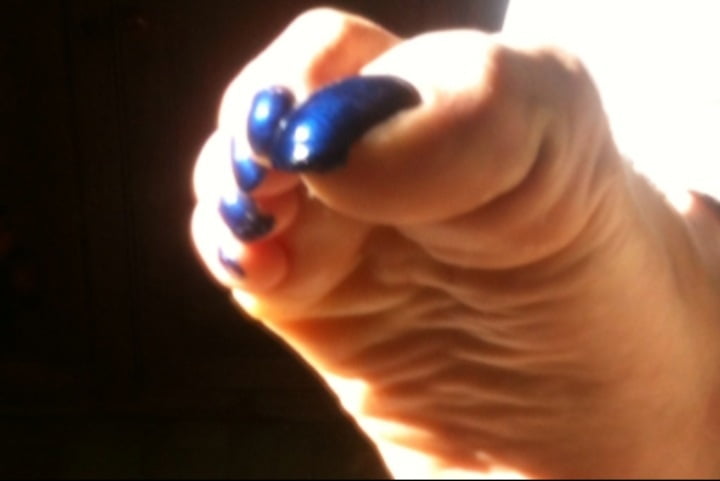 Blue toenails under sun ray #106845646