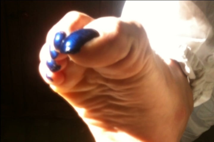 Blue toenails under sun ray #106845647