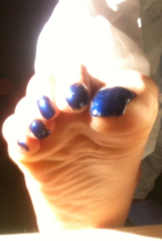 Blue toenails under sun ray #106845654