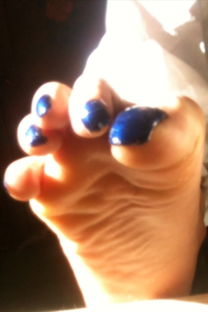 Blue toenails under sun ray #106845655