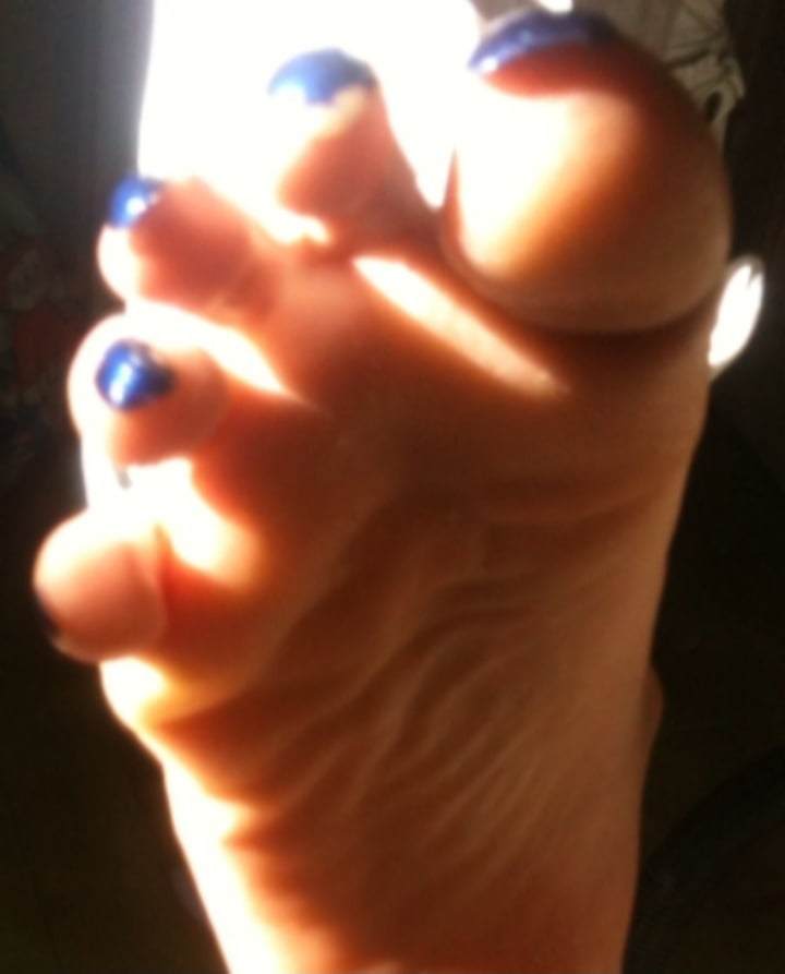Blue toenails under sun ray #106845659