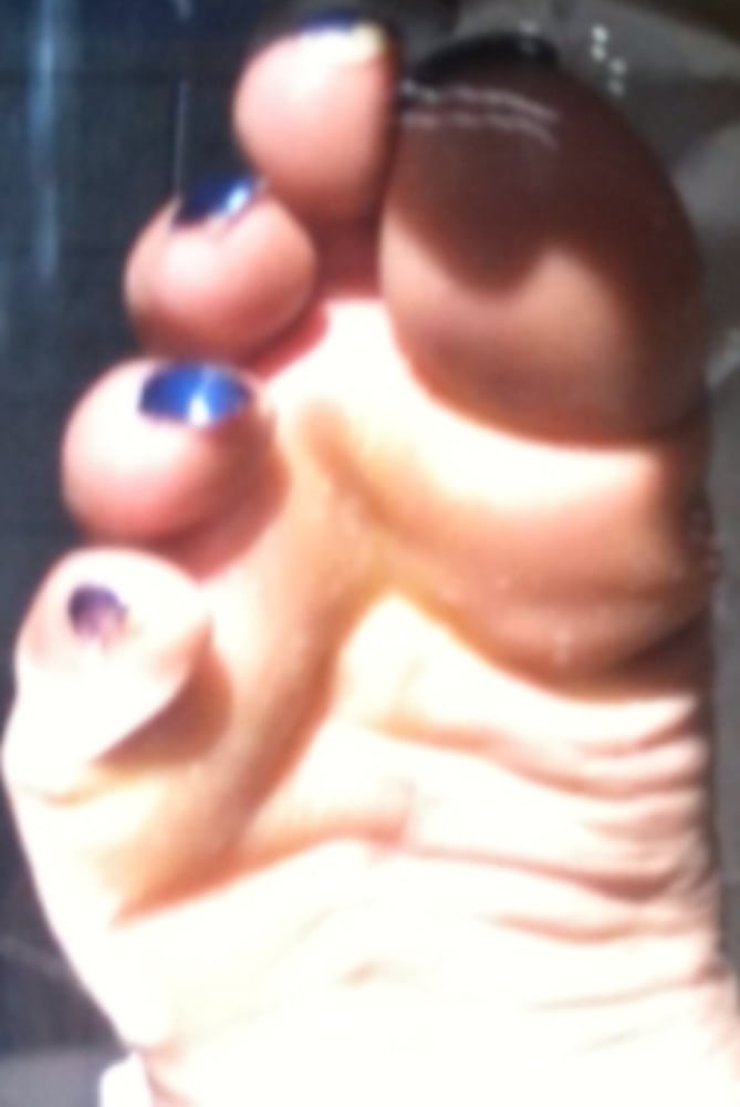 Blue toenails under sun ray #106845661