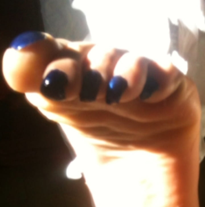 Uñas de los pies azules bajo los rayos del sol
 #106845664