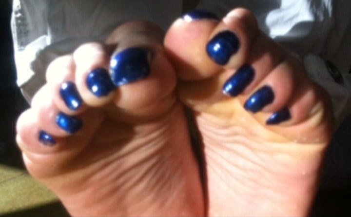 Blue toenails under sun ray #106845672