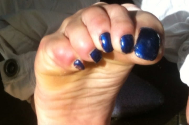 Blue toenails under sun ray #106845673