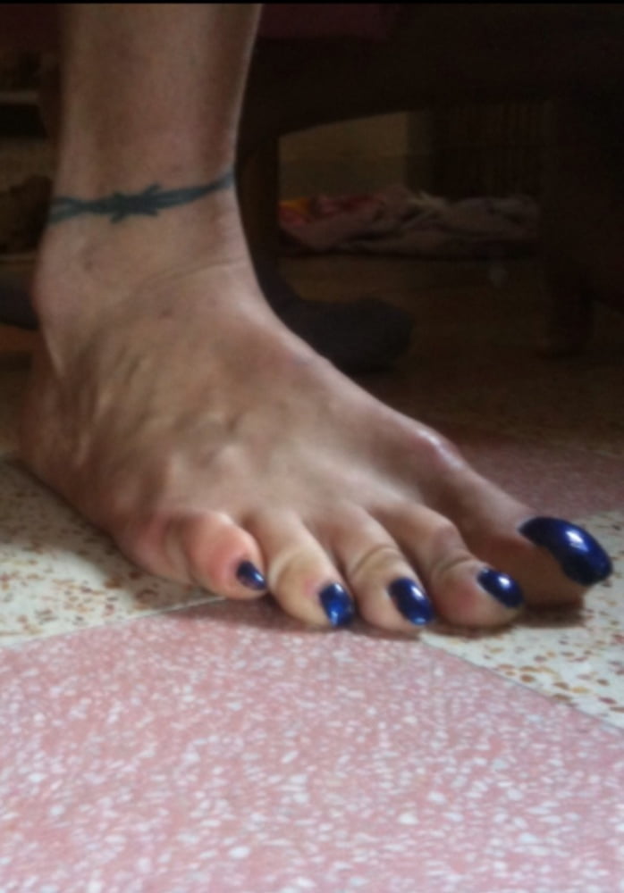 Blue toenails under sun ray #106845677