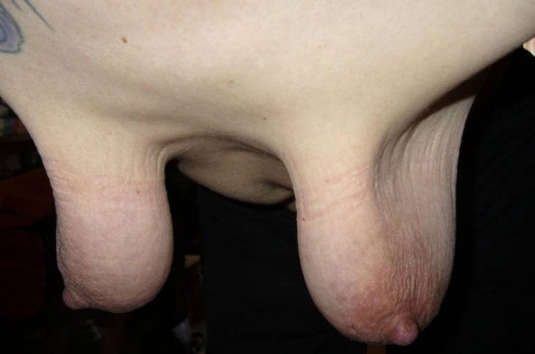 Wunderbare webfound saggy tits
 #98735593