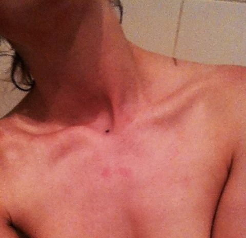 スキニー・タトゥー・ティーン
 #81605518