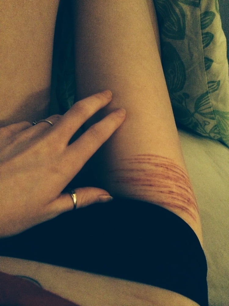 スキニー・タトゥー・ティーン
 #81605612