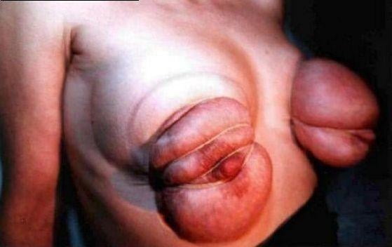 Pechos comprimidos
 #95316658