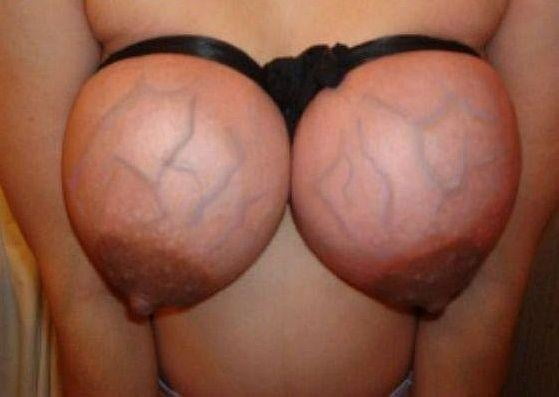 Pechos comprimidos
 #95316757