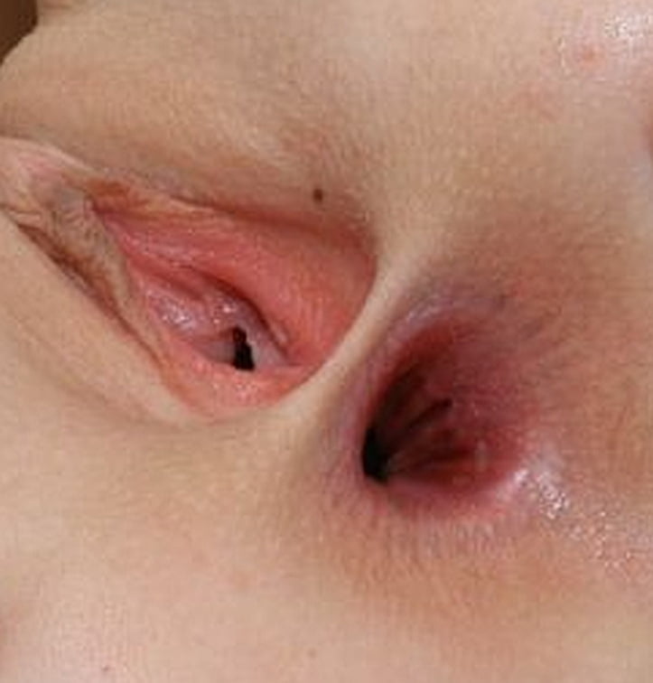 Geile Pussy&#039;s2 #87614879