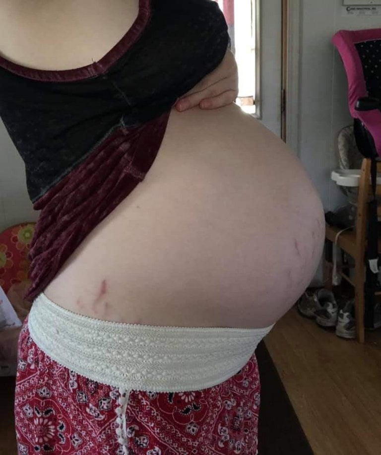 preg. #89186183