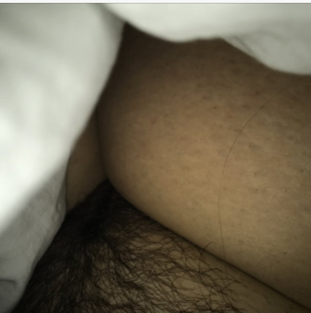 Más fotos
 #106467591