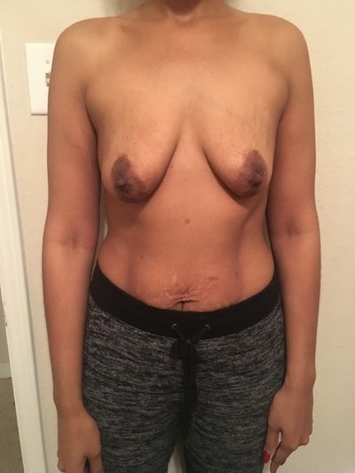 Saggy breast vol 26
 #93138120