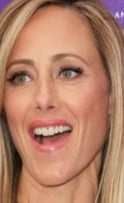 Kim raver
 #88879823