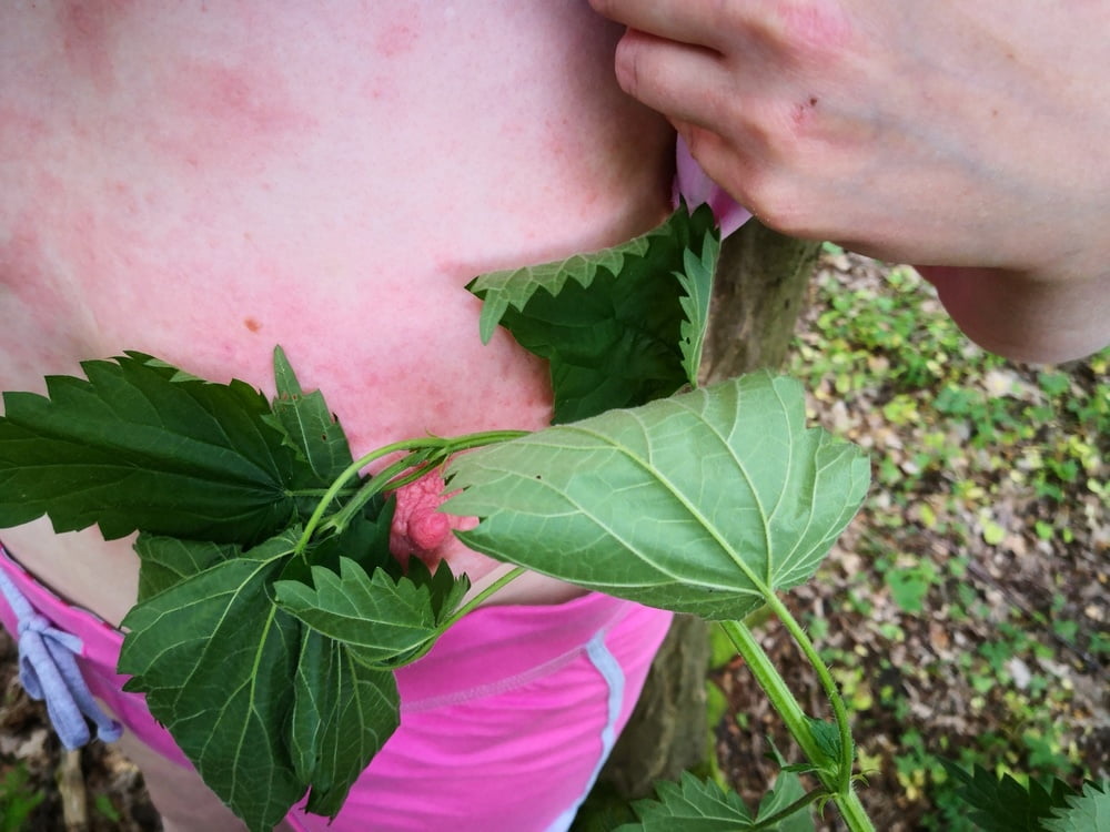 Brennnesseln en las tetas #106392518