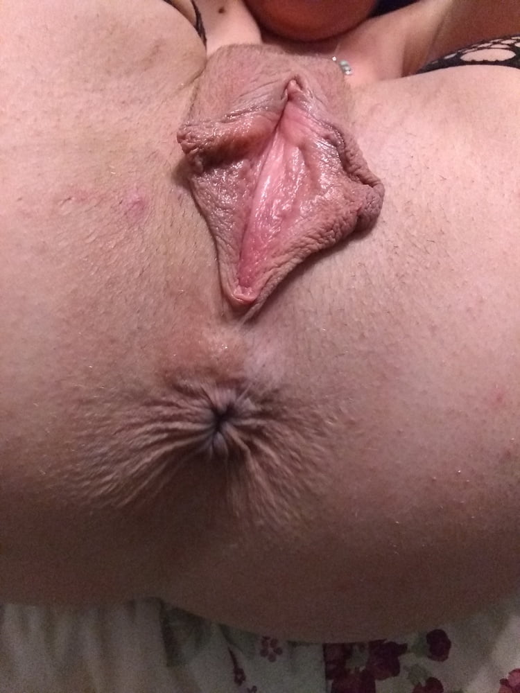 My asshole and pussy lips #107078521