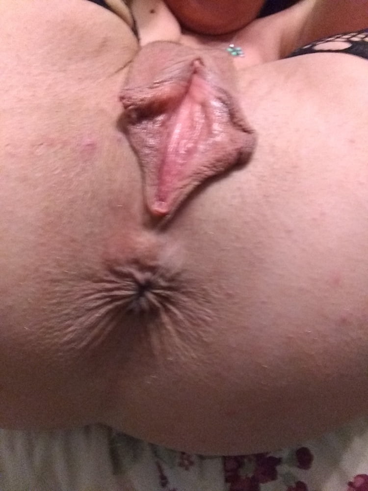 My asshole and pussy lips #107078522