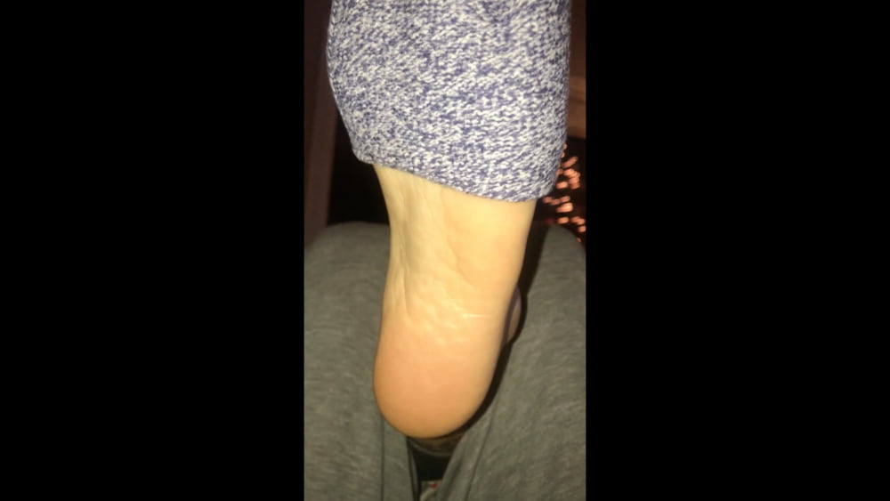 手のひらサイズのファンタジー
 #99844720