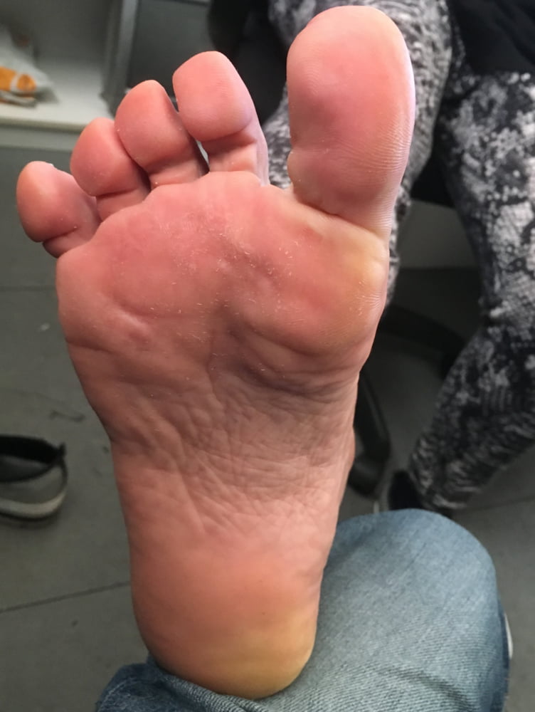 Piante dei piedi mature
 #103907160