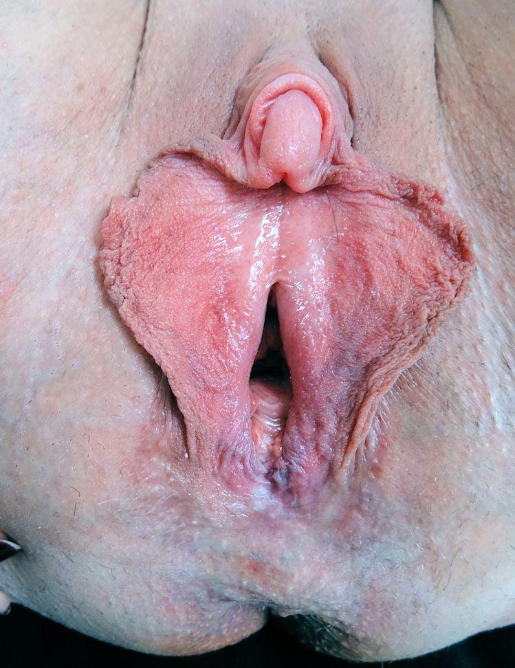 Large pessy #91350711