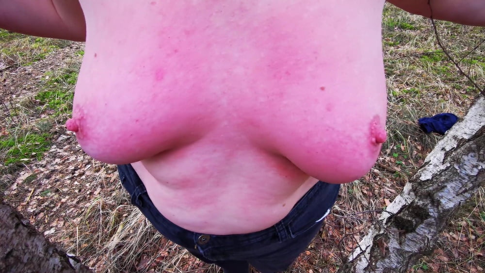 Titslapping In Woods