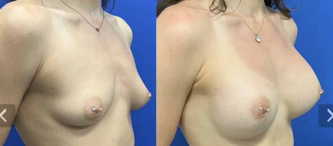 Taylor Stewart nude #108324387