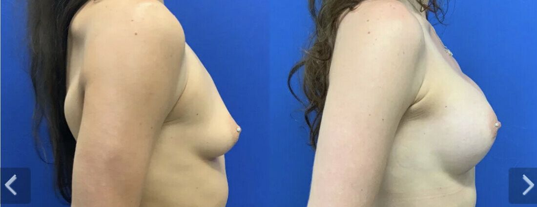 Taylor Stewart nude #108324388