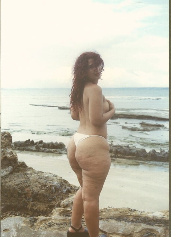 Best cellulite bums 5 #96615575