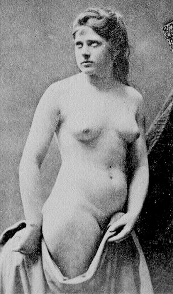 Natürlich und haarig
 #103559714