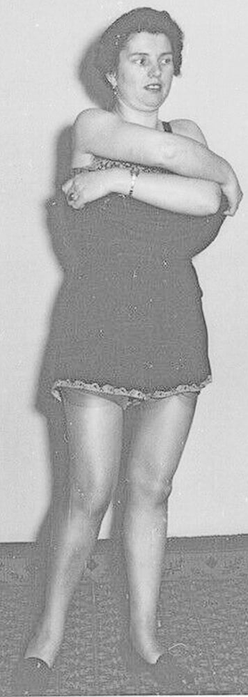 Natürlich und haarig
 #103559998