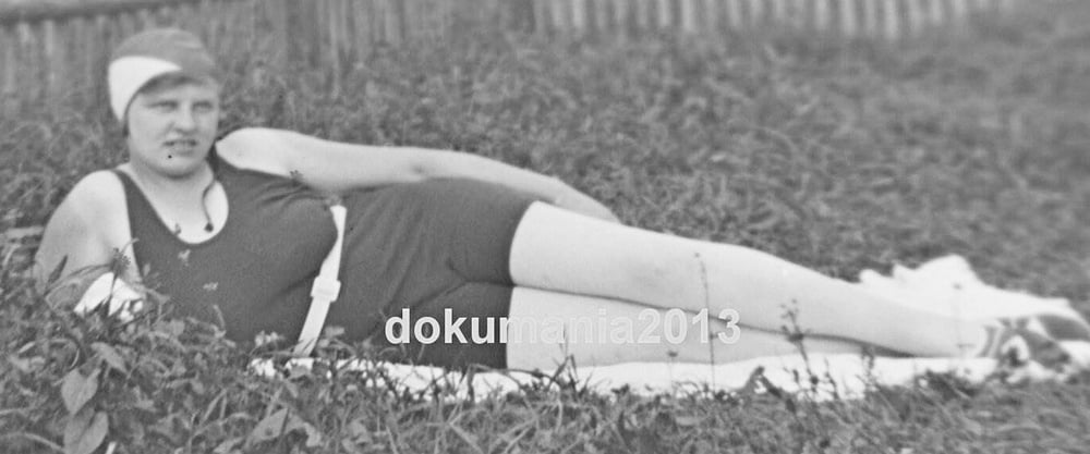 Natürlich und haarig
 #103560025