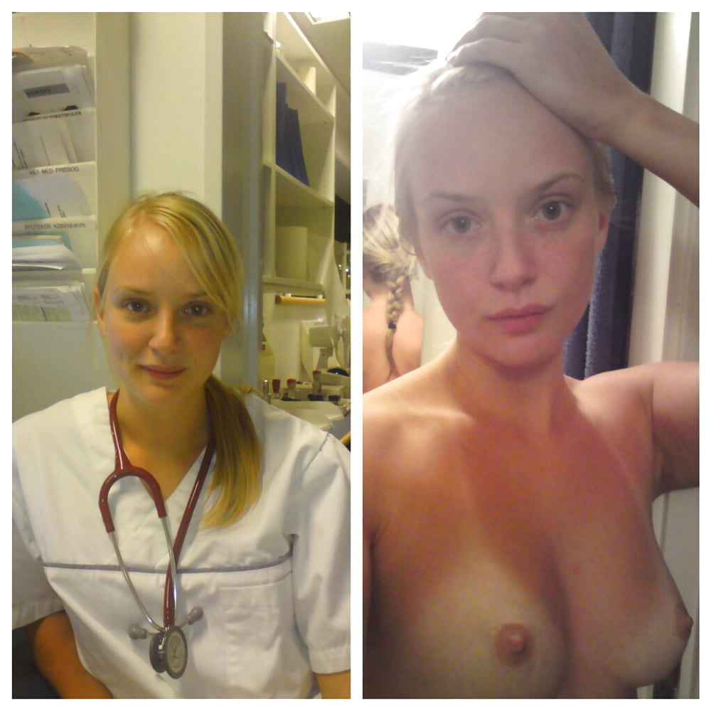 Before And After #89822814