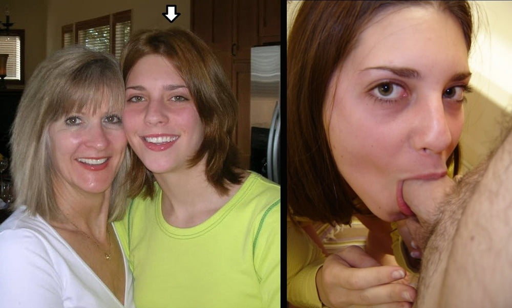 Before And After #89822835