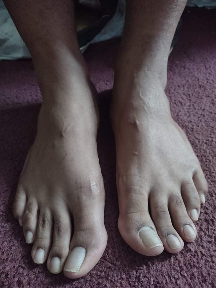 My awesome man feet 1 #106873197