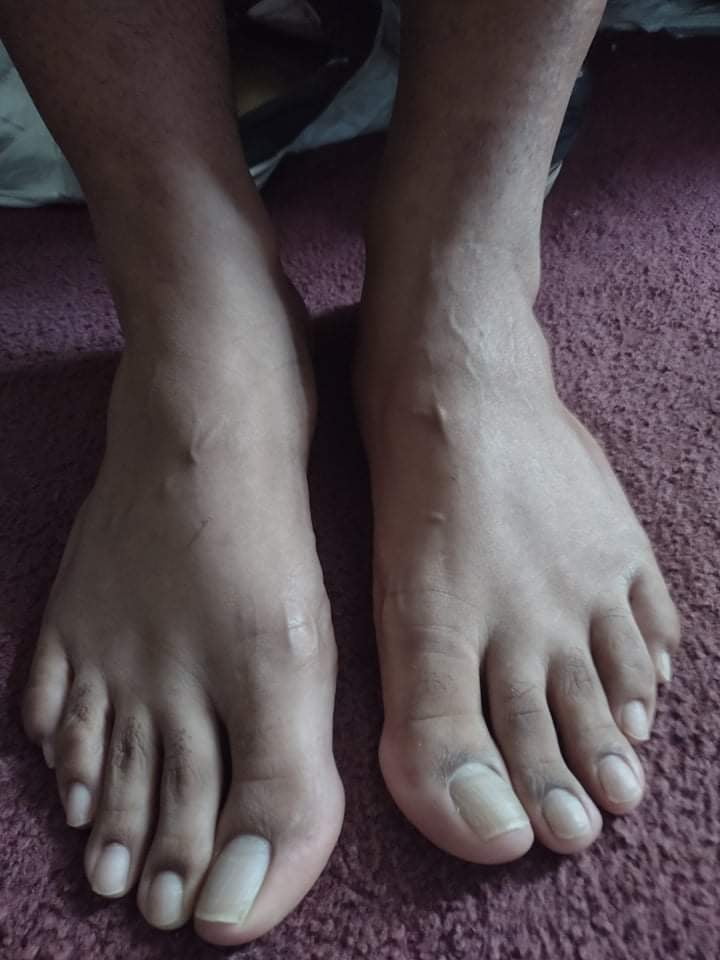 My awesome man feet 1 #106873198