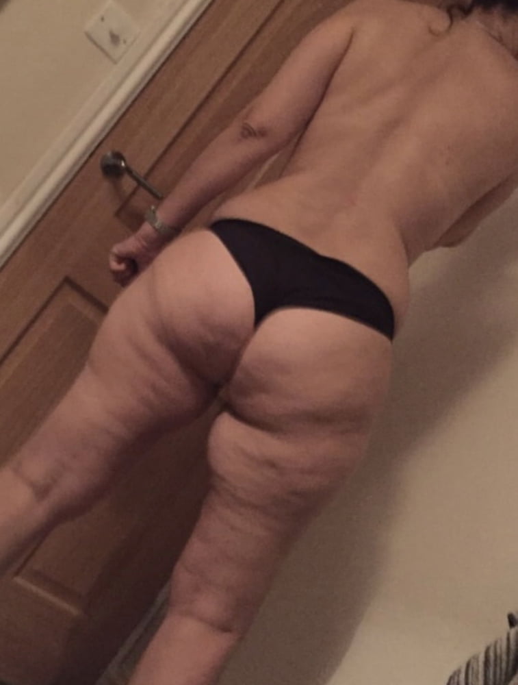 Celulitis diosas 4
 #89561183