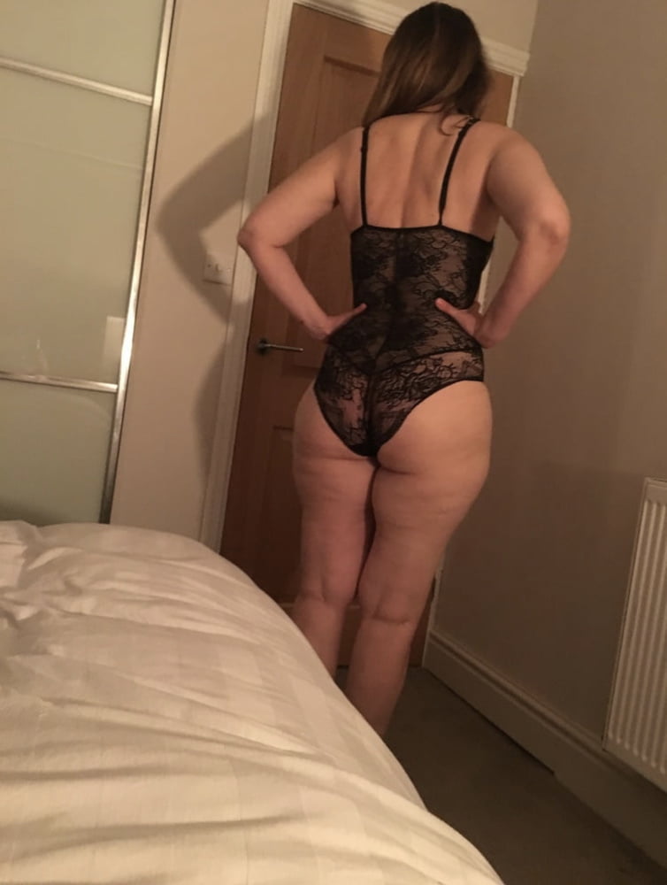 Celulitis diosas 4
 #89561187