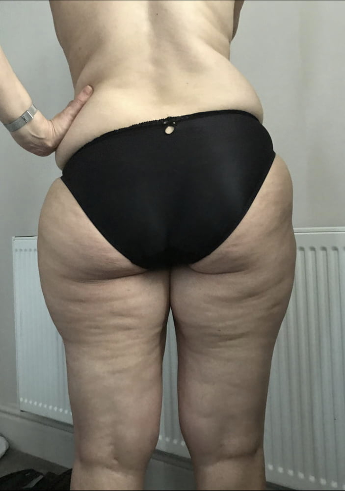 Celulitis diosas 4
 #89561202