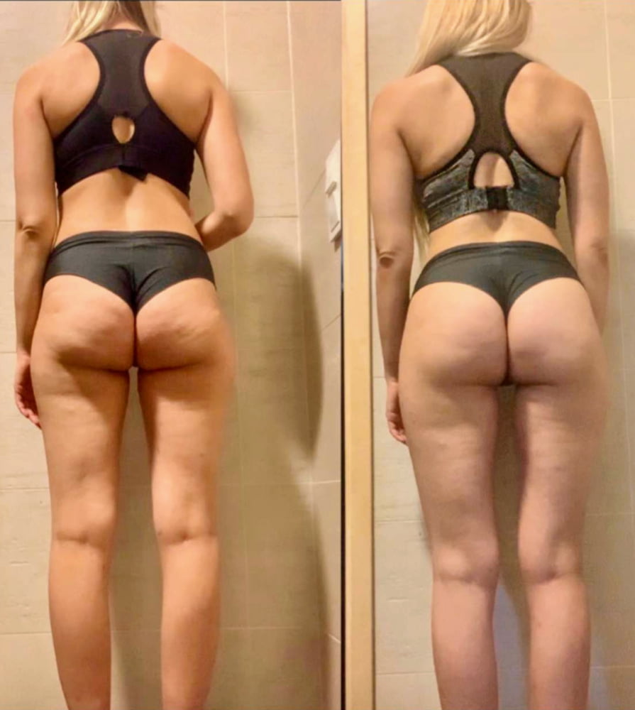 Before after booty #95160131