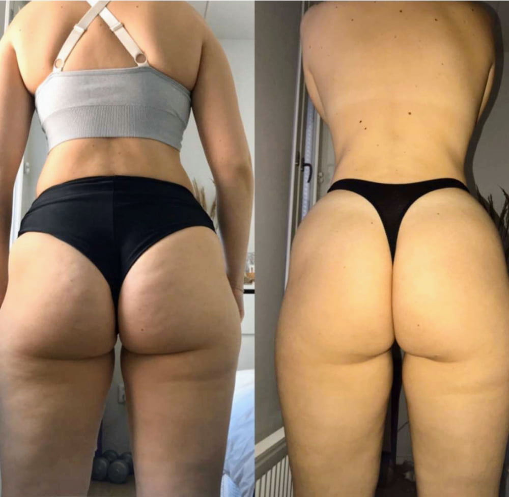 Before after booty #95160134