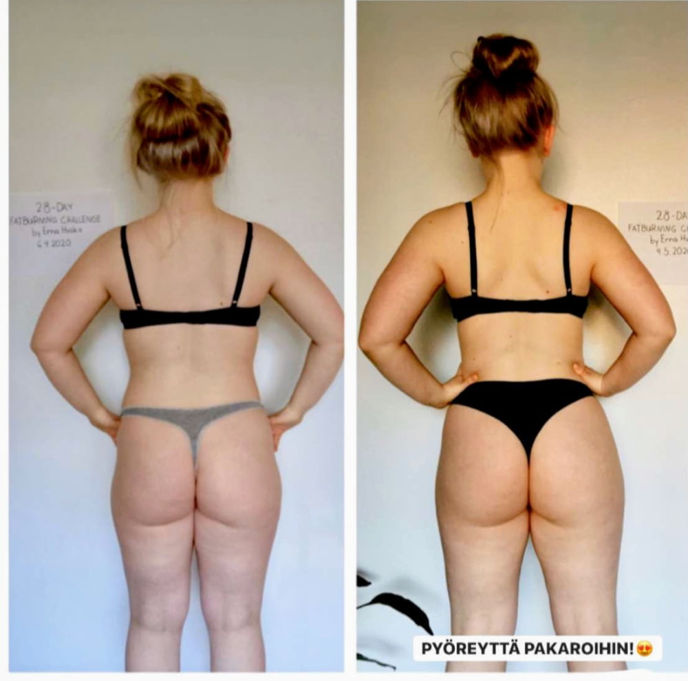 Before after booty #95160143