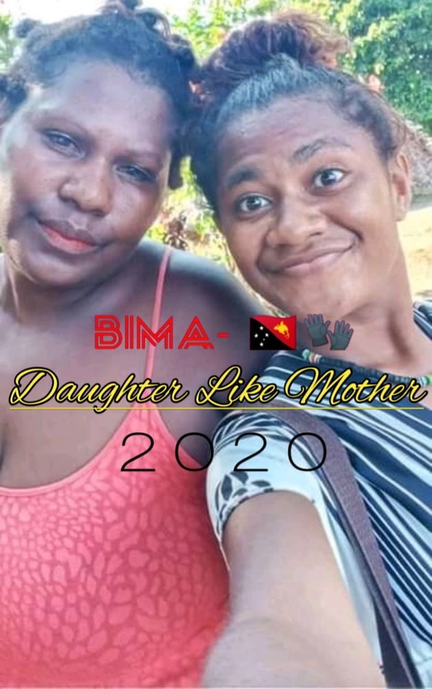 Bima #94082669